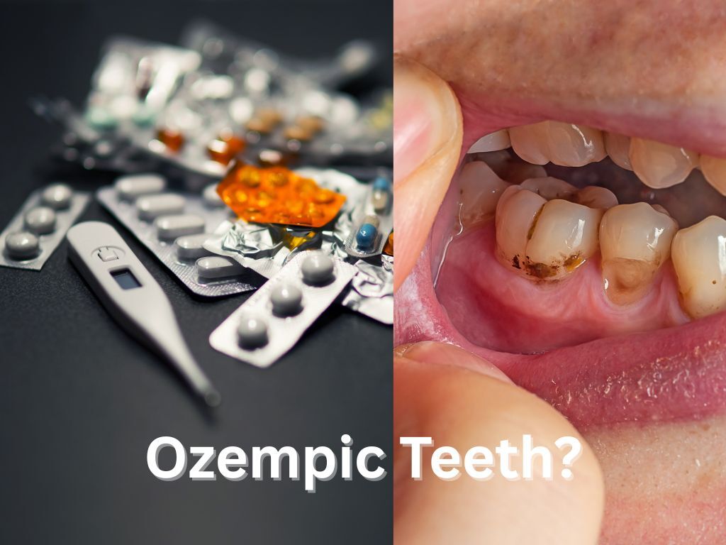Ozempic Teeth: From Waist Line To Gum Line Ozempic Teeth: From Waist Line To Gum Line